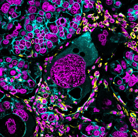 Unveiling the Intricacies of Polyploid Cells: A Key to…