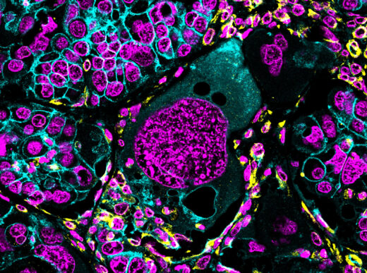 Unveiling the Intricacies of Polyploid Cells: A Key to Stress Response and Evolutionary Survival